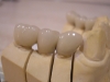 implant3_s