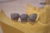 implant5_s